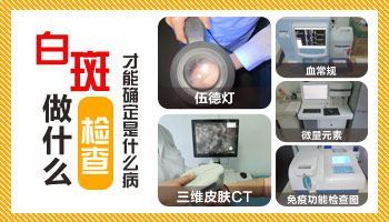 白癜风早期症状舌头